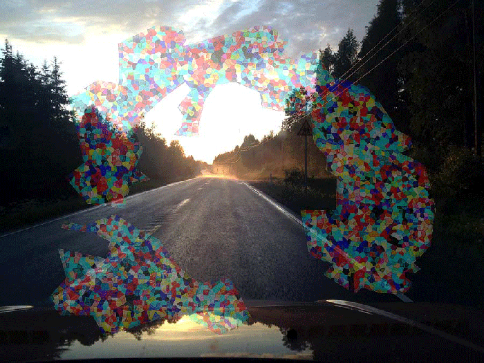 Migraine headaches and aura